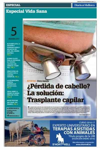 Doctor José María Mir en Diario de Mallorca. Injerto capilar Doctor José María Mir en Diario de Mallorca. Injerto capilar