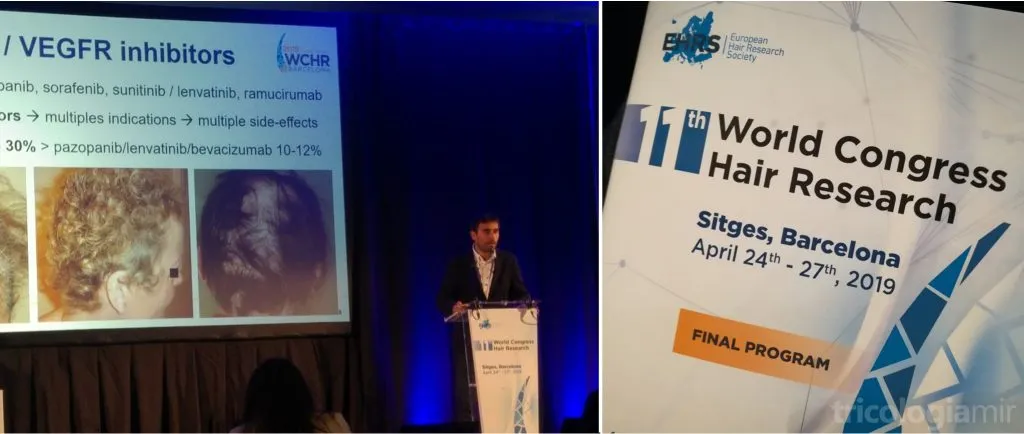 Joan Mir como ponente sobre reacciones capilares por fármacos diana en el 11th World Congress Hair Research en Sitges, Abril de 2019.